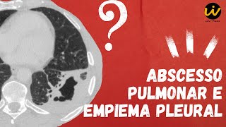 ABSCESSO PULMONAR e EMPIEMA PLEURAL  Tomografia de Tórax [upl. by Bush]