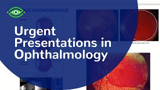 Essential Eyes urgent presentations in ophthalmology Fri 01 Feb [upl. by Feodor]