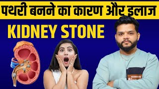 पथरी बनने का कारण और इलाज  Kidney Stone In Hindi [upl. by Skvorak]