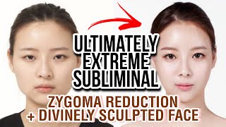 MOST ICONIC SUBLIMINAL❗ Angelic Face Zygoma Reduction Narrow Cheekbones upgraded formula [upl. by Almeida]