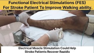 Rehabilitation After Stroke Functional Electrical Stimulation FES Facilitates Walking [upl. by Agatha]