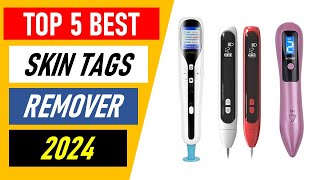 Top 5 Best Skin Tags Remover in 2024 [upl. by Christa]