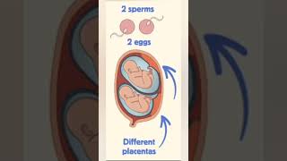 twins pregnancy baby conceive pregnancysigns viral [upl. by Pompea837]