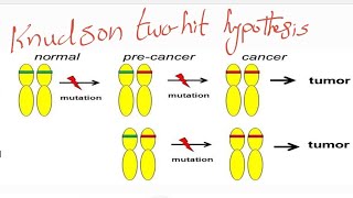 knudson two hit hypothesis compound heterozygote and consanguinty [upl. by Purpura]