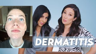 Perioral Dermatitis and Acne Skincare Routine for Jessie [upl. by Lapides]