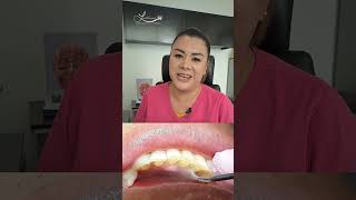 👉 Como quitar las Manchas Tabaco y Sarro en los Dientes 😱🦷 [upl. by Chandal]