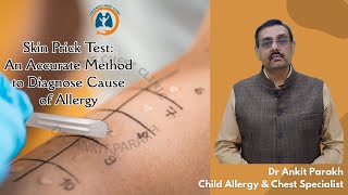 Skin Prick Test or SPT How Theyre Performed I Dr Ankit Parakh Allergy Specialist [upl. by Meeker468]