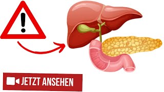 ⚠️6 Wege um GALLENSTEINE aufzulösen [upl. by Paget661]