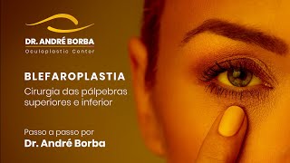 Blefaroplastia ou cirurgia das pálpebras superiores e inferiores  Passo a passo por Dr André Borba [upl. by Alleen]