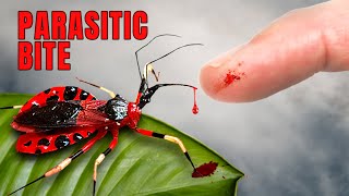 ASSASSIN BUG puts me in the Hospital [upl. by Ariam873]