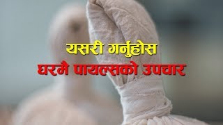 घरमै पायल्सको उपचार । Piles Treatment Home Remedy [upl. by Eyk582]