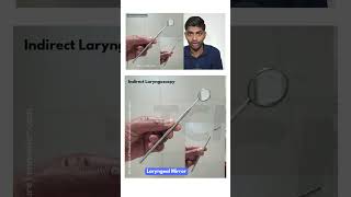 Laryngoscopy ent inicet neetpg [upl. by Lanoil]