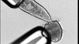 Didinium eats Paramecium [upl. by Hayman]