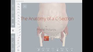 Primal Pictures Csection [upl. by Annah487]