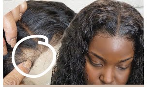 How to fix your BALD LACE WIG [upl. by Anialem]