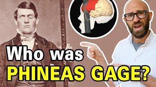 The Remarkable Tale of Phineas Gage [upl. by Krissie]