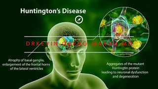 🧬 Huntingtons Diseases  USMLE 🇺🇸 STEP 1 2CK 3 Board Review Tips [upl. by Sibyls]