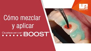 Cómo mezclar y aplicar el blanqueamiento dental médico Opalescence™ Boost™ [upl. by Eek]