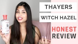 Thayers Witch Hazel Review Is it Worth the Hype  Social Nupur [upl. by Ahsenat]