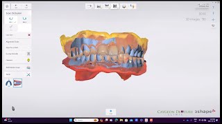 Reference Denture Intraoral Scans [upl. by Anadal]