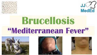 Brucellosis Mediterranean Fever  Transmission Pathogenesis Symptoms Diagnosis Treatment [upl. by Anierdna]