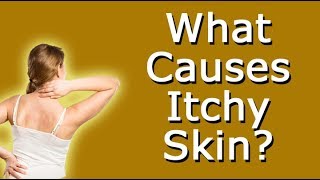 What Causes Itchy Skin [upl. by Ecyal]