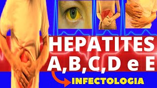 HEPATITES A B C D e E  CARACTERÍSTICAS SINTOMAS DIAGNÓSTICO E TRATAMENTO  INFECTOLOGIA [upl. by Silsby]