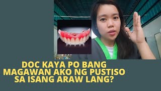 Provisionary or Temporary Denture VS Well Fitted Denture at ang Proseso nang Paggawa Ng Pustiso [upl. by Ynahirb594]