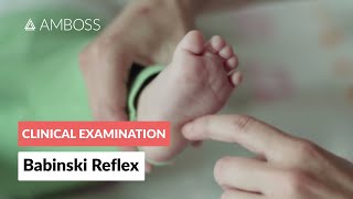 Babinski Reflex in Infants  Clinical Examination [upl. by Annor]