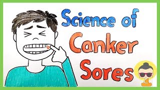 Why do we get canker sores Types  Prevention [upl. by Diahann]