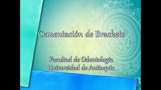 Odontología  Cementación de Brackets [upl. by Htilil]