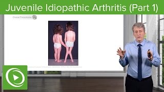 Juvenile Idiopathic Arthritis JIA Pathology amp Clinical Presentation – Pediatrics  Lecturio [upl. by Xela]