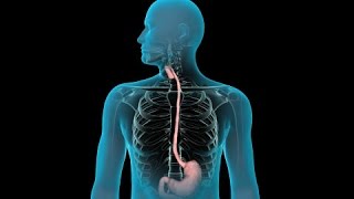 Endoscopia Gastrointestinal Superior [upl. by Patty]