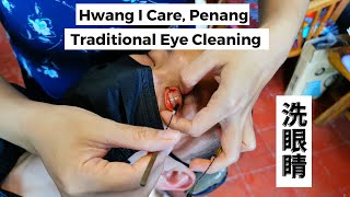 Traditional Eye Cleaning Penang  槟城传统洗眼睛 [upl. by Thorlay]