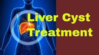 What are the Treatments for a Liver Cyst [upl. by Selie]