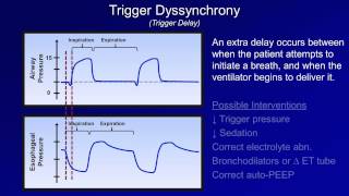 Pathologic Complications Mechanical Ventilation  Lecture 11 [upl. by Etiragram]