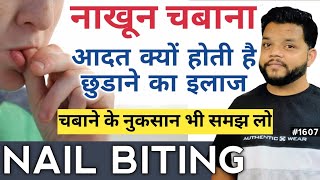 नाखून चबाने की आदत छुड़ाएं  Nail Biting Habits Causes amp Treatment [upl. by Kristofer]