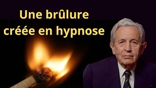 Mon analyse  Une brûlure créée en hypnose Dr Léon Chertok [upl. by Rockwell]