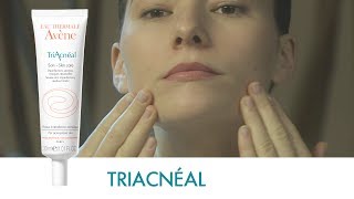 Triacnéal [upl. by Adas]