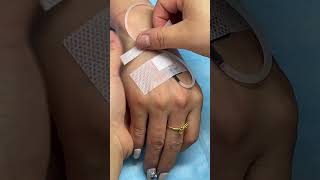 IV INSERTION MATHOD 💉🩺health ivinfusion viral hospital shorts [upl. by Yadahs]