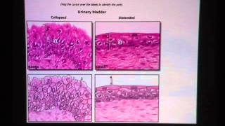 Transitional Epithelium [upl. by Farmann]