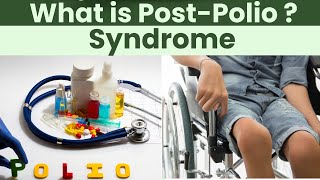 Post Polio Syndrome  Causes Symptoms and Treatment [upl. by Solahcin925]