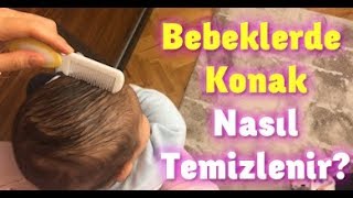 Bebeklerde Konak Nasıl Geçer bebeklerdekonak konak [upl. by Ayar318]