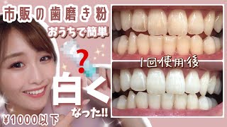 【驚愕‼︎】1回の歯磨きで歯が白く！ステイン着色汚れが気になる人必見！お家でお手軽【ホームホワイトニングケア】 [upl. by Annelise]