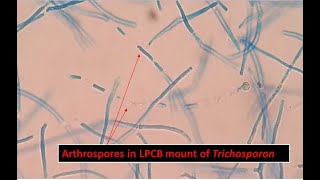 Arthroconidia of Trichosporon inkin Showing Long Cylindrical in Shape [upl. by Bendicta]