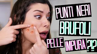 PUNTI NERI BRUFOLI E PELLE IMPURA😱COME RICEVERE PRODOTTI GRATIS  💸  Adriana Spink [upl. by Settle745]