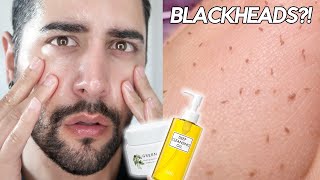 Testing An Esthetician Approved Oil Cleansing Routine  OIL PLUGS BLACKHEADS ✖ James Welsh [upl. by Sperry519]