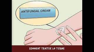 Comment traiter la teigne [upl. by Anaiviv]