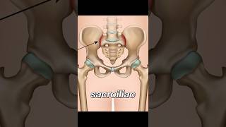 Sacroiliitis  lower back pain [upl. by Dorothee407]