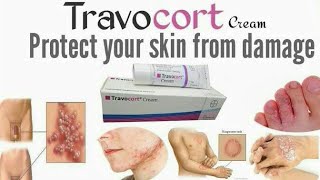 Travocort cream benefitsAntifungal Cream [upl. by Eeralih]